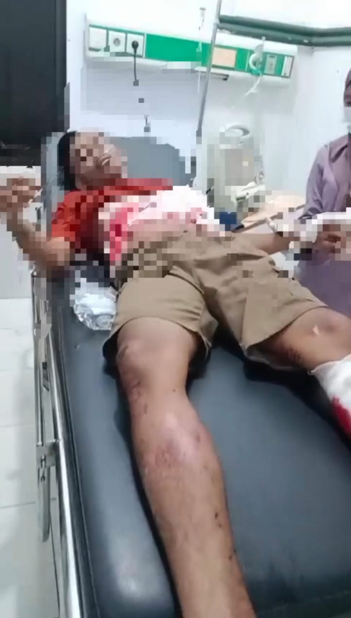 Emosi Dengar Ocehan Kasar, Kakak Aniaya Adik Kandung